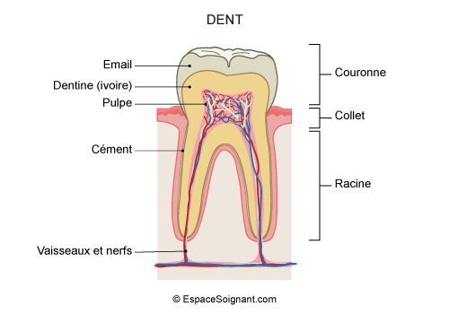 Dent