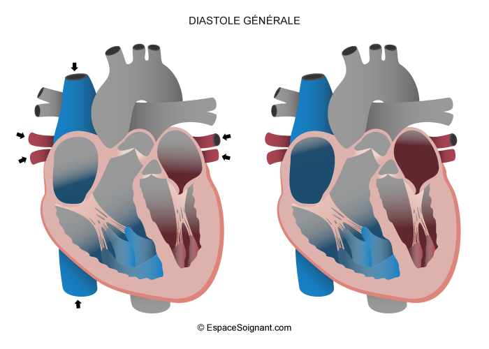 Diastole générale