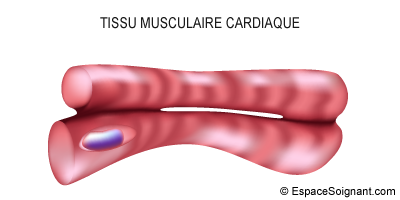 Tissu musculaire cardiaque