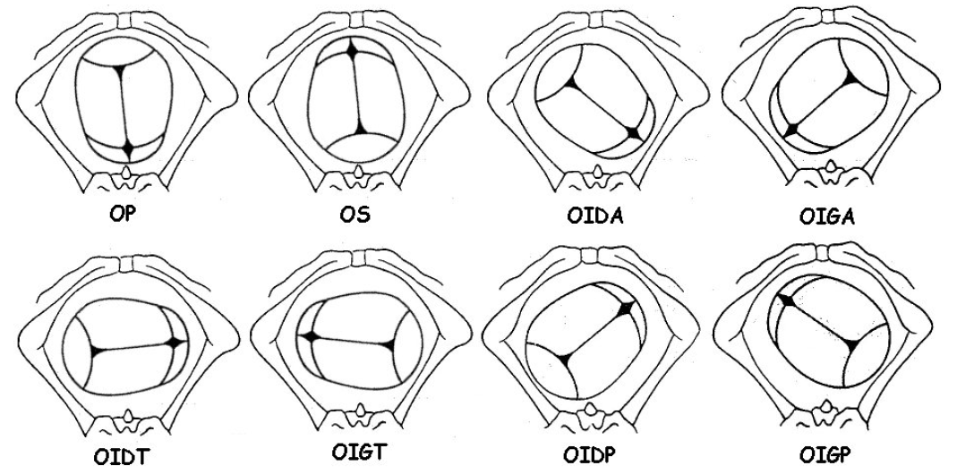 Présentation du sommet foetale