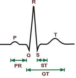 Electrocardiogramme normal : tracé sinusal