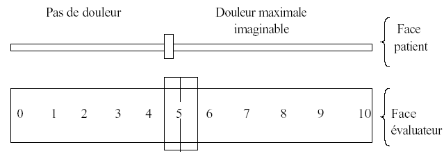 Echelle Visuelle Analogique (EVA)