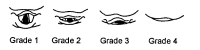 Grades de Cormack