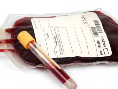 Transfusion sanguine